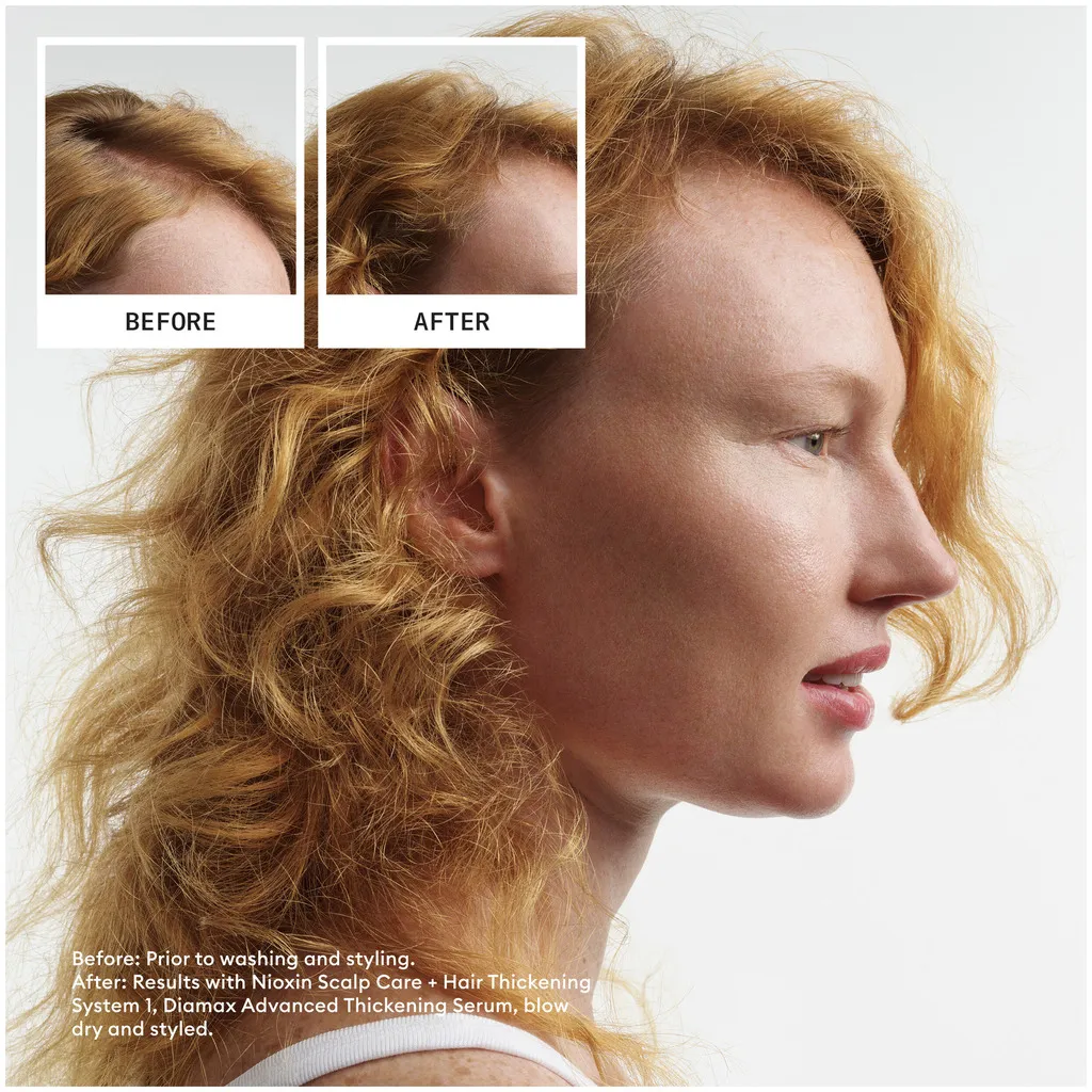 Nioxin Scalp Care + Hair Thickening Treatment System 1