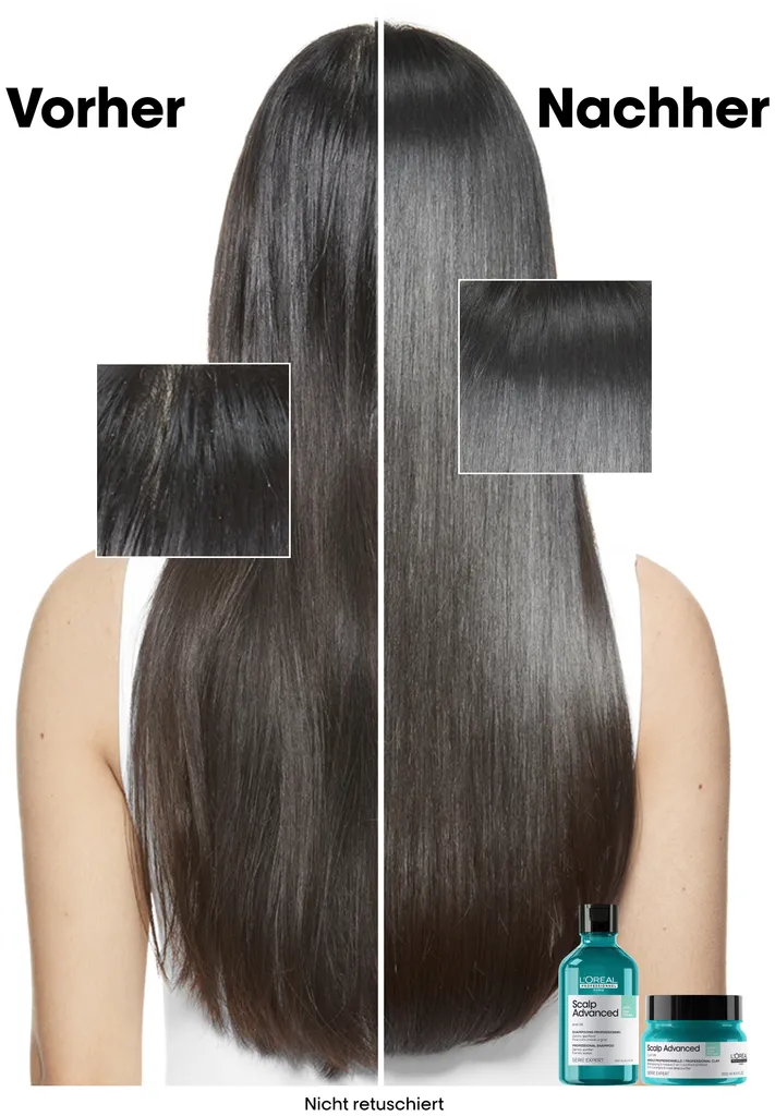 L'Oréal Scalp Advanced Anti-Oiliness Dermo Purifier Shampoo