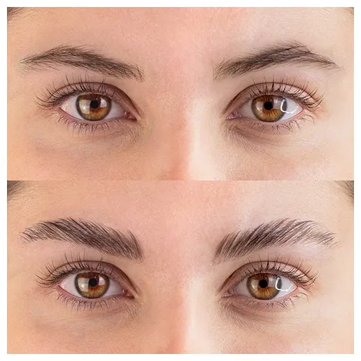 Fleeky Browlift Kit Maxi