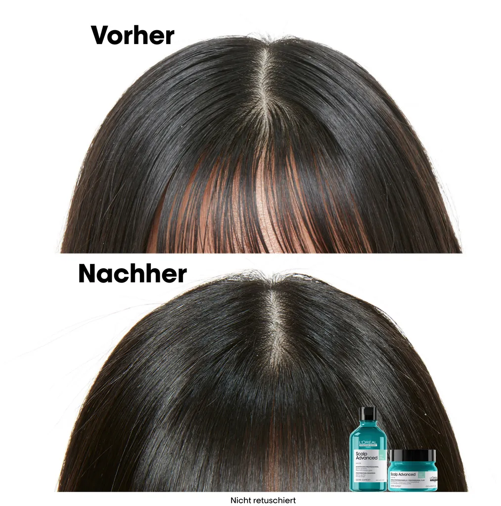 L'Oréal Scalp Advanced Anti-Oiliness 2-in-1 Deep Purifier Clay