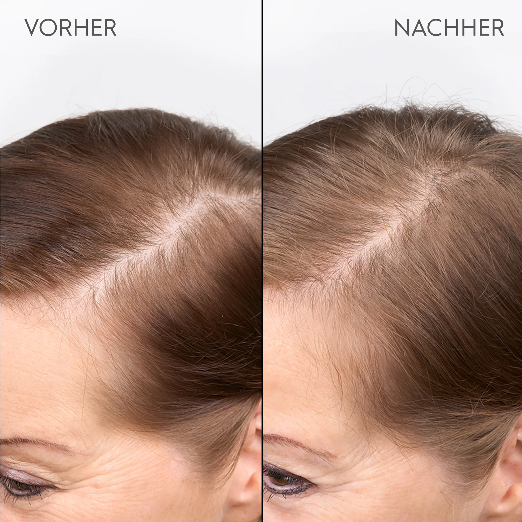 Kerasilk Verdichtendes Kopfhautserum