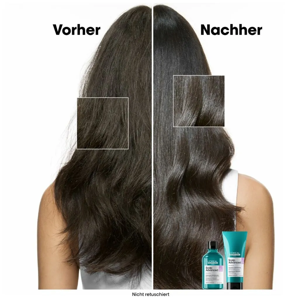 L'Oréal Série Expert Scalp Advanced Anti-Discomfort Dermo-Regulator Refill Shampoo