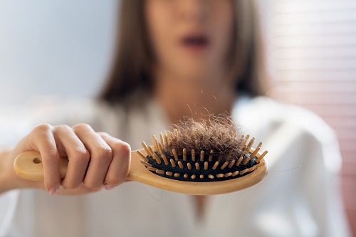 Haarbürste voll mit ausgefallenen Haaren