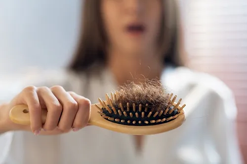 Haarbürste voll mit ausgefallenen Haaren