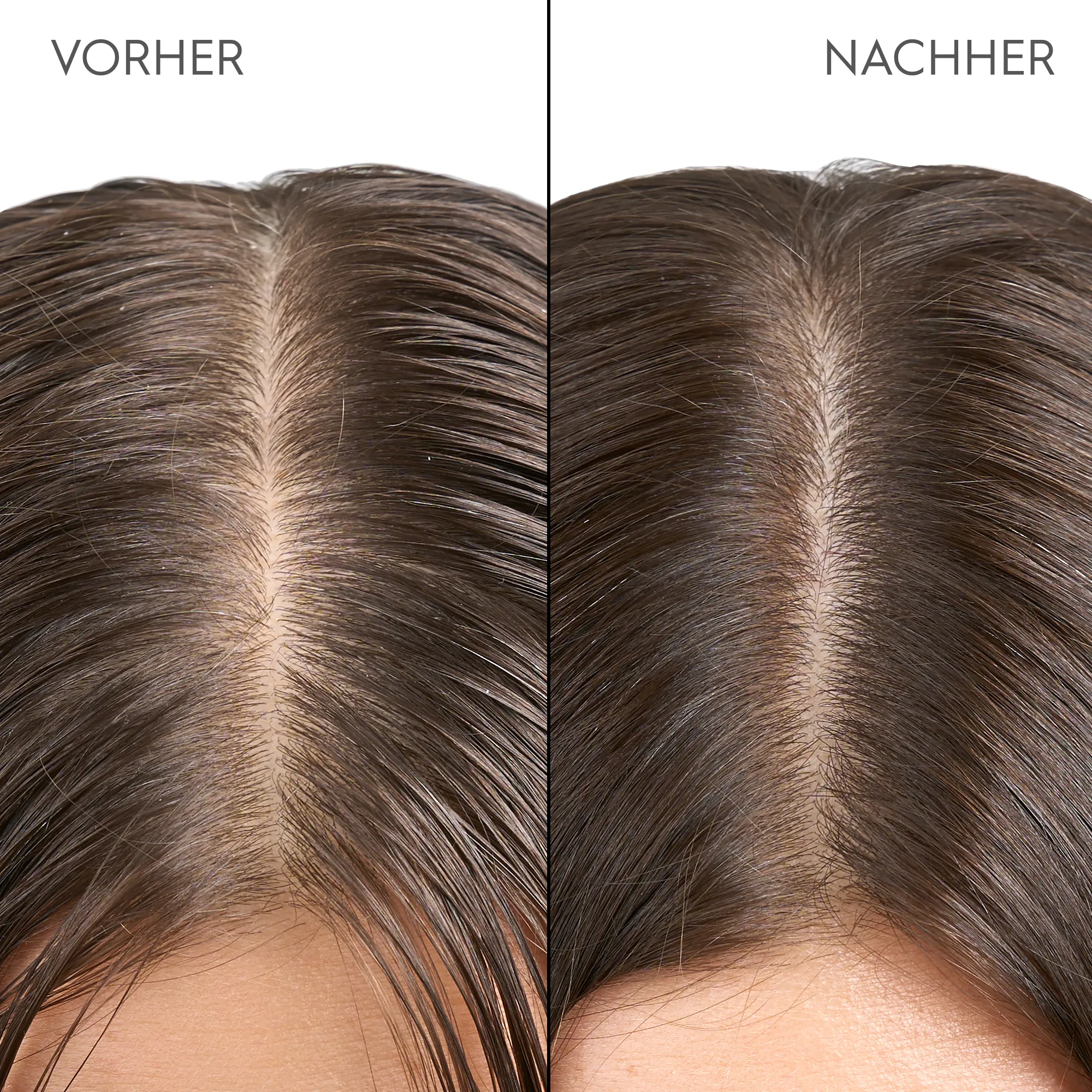 Kerasilk Kopfhaut & Haarpeeling