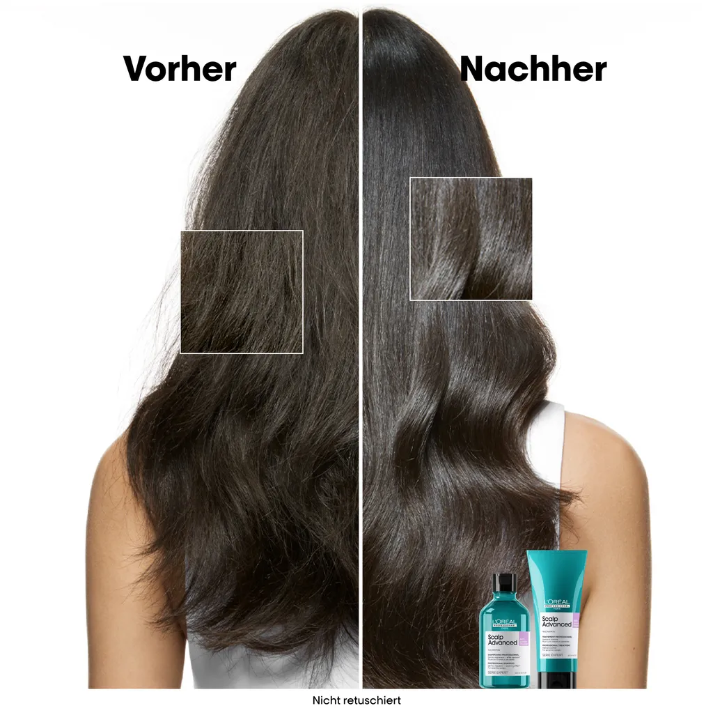 L'Oréal Scalp Advanced Anti-Discomfort Dermo-Regulator Shampoo