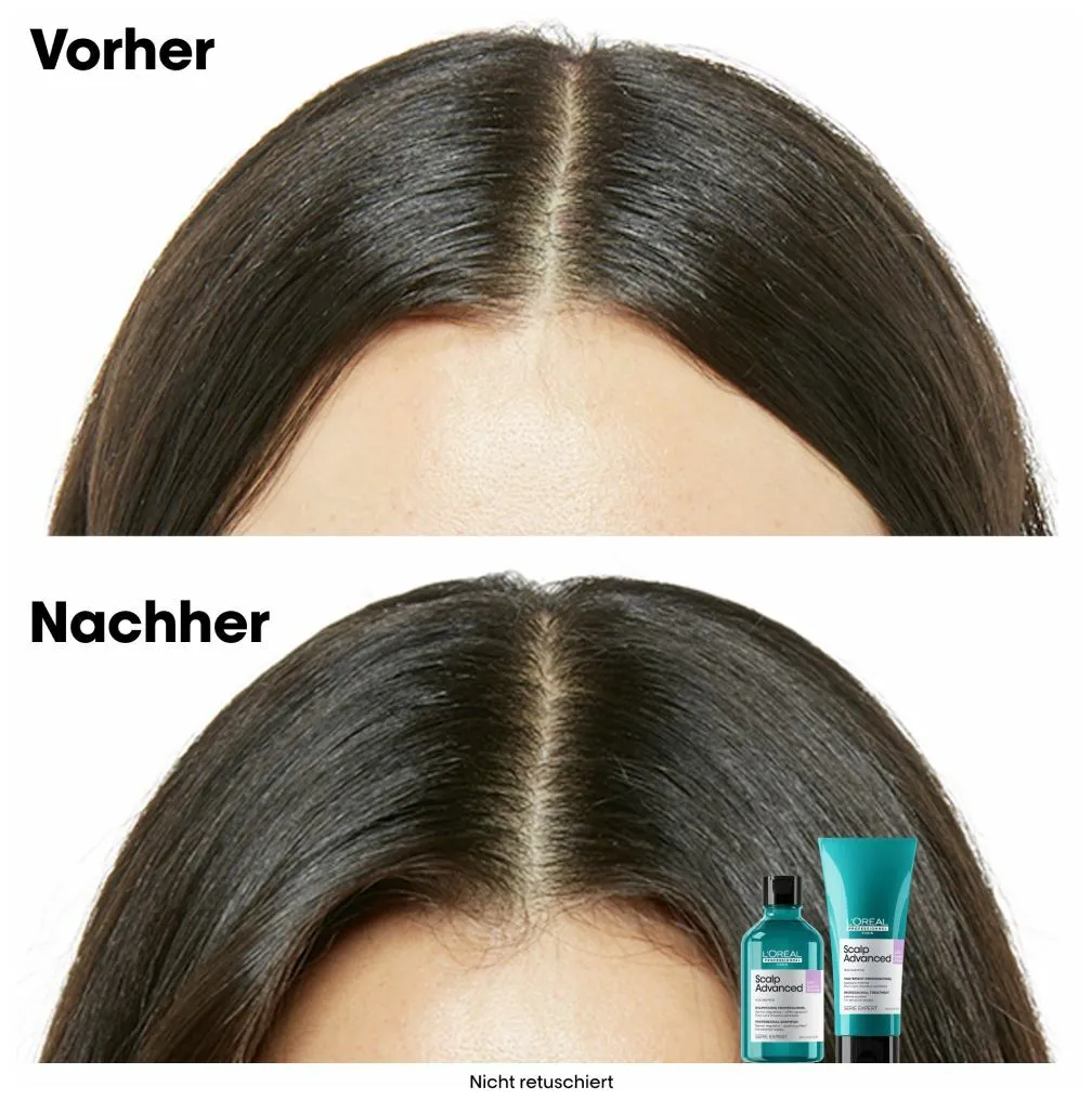 L'Oréal Série Expert Scalp Advanced Anti-Discomfort Dermo-Regulator Refill Shampoo